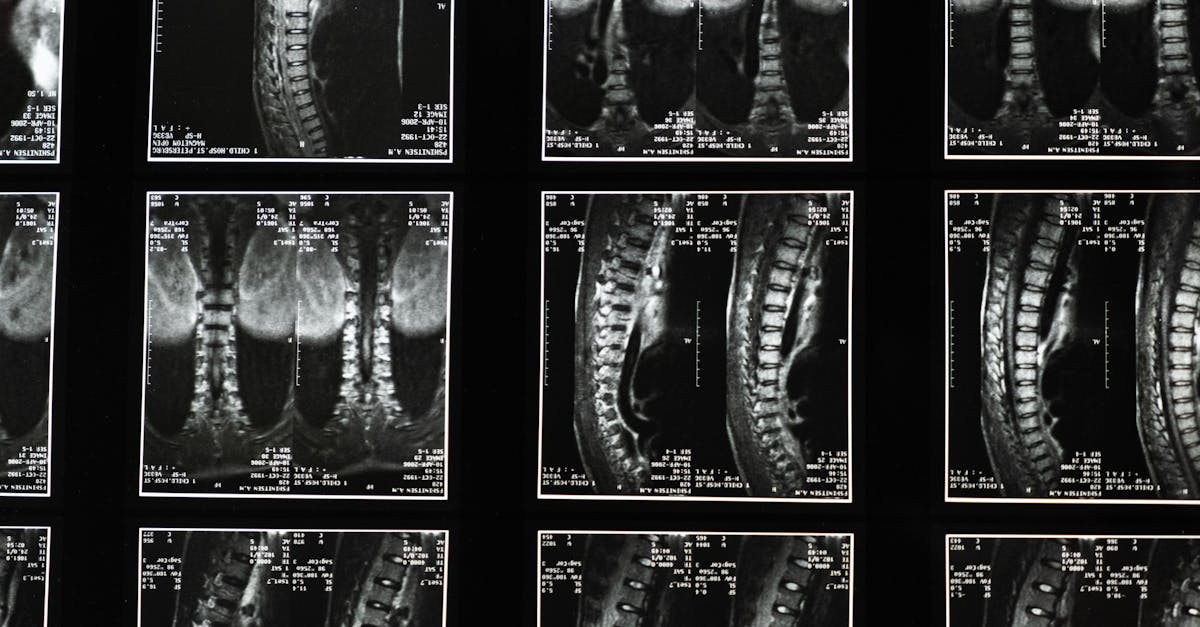 How does a medical imaging work?