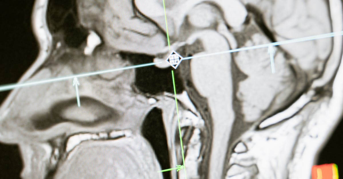 Is medical imaging the same as radiography?