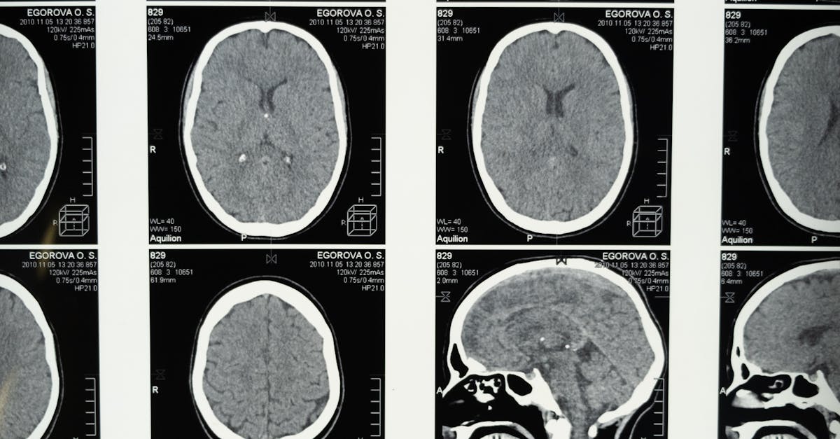 What is the medical imaging?