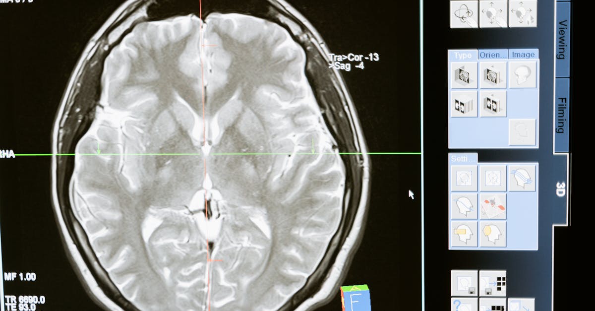 What is the most accurate imaging?