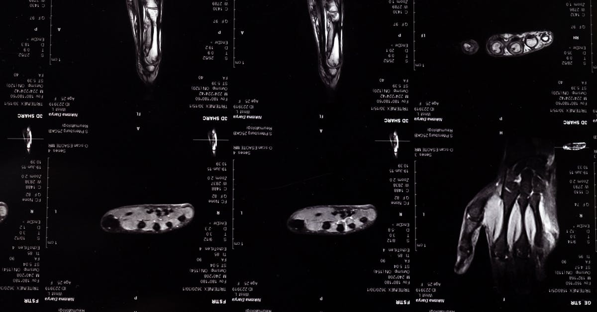 What is the most detailed medical imaging?