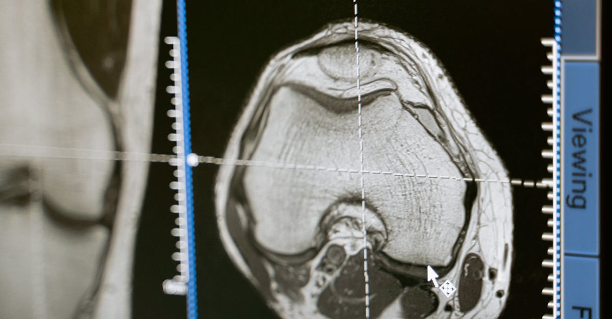 Why does radiology pay so much?